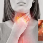 “Occhio a questi sintomi”: reflusso gastrico, possibile legame con un tumore. L’allarme