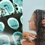 Alzheimer, il primo sintomo si manifesta durante la doccia: il segnale che quasi nessuno riconosce