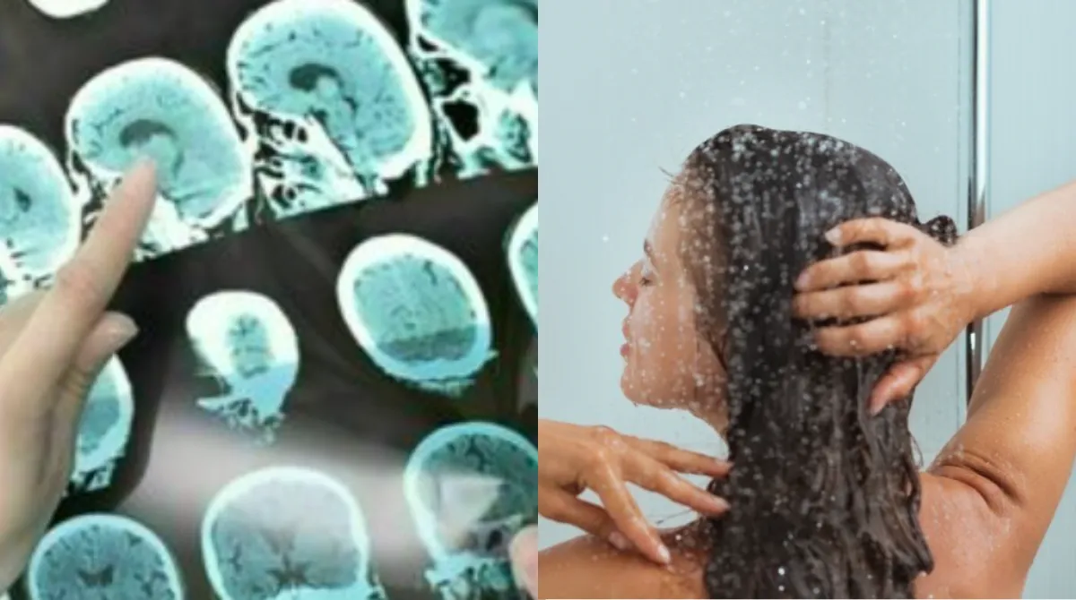 Alzheimer, il primo sintomo si manifesta durante la doccia: il segnale che quasi nessuno riconosce