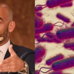 Allarme sifilide in Italia: Bassetti lancia l’allarme