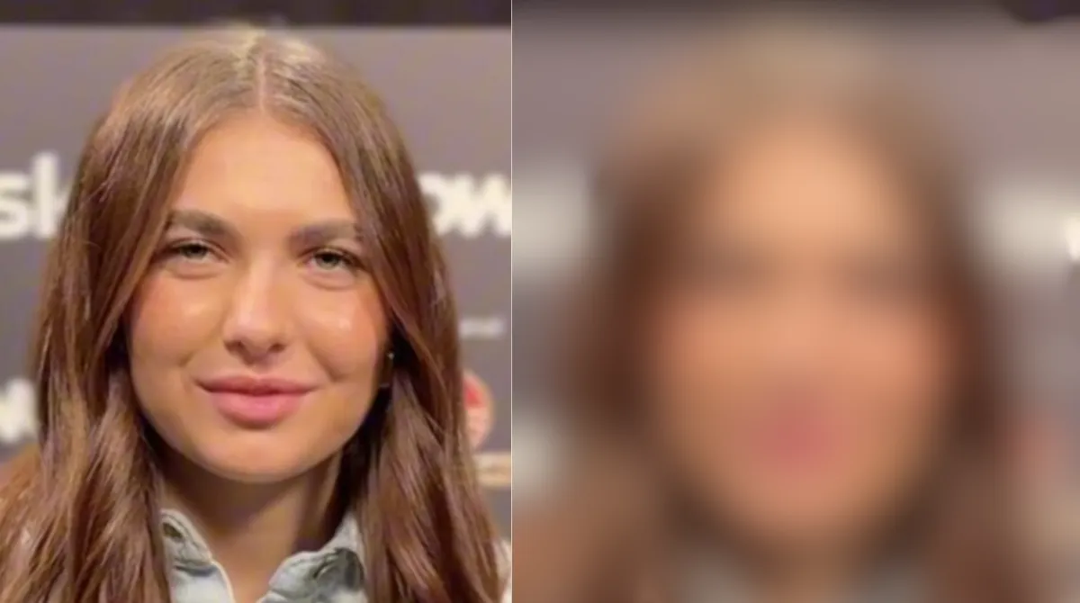 chanel totti prima e dopo