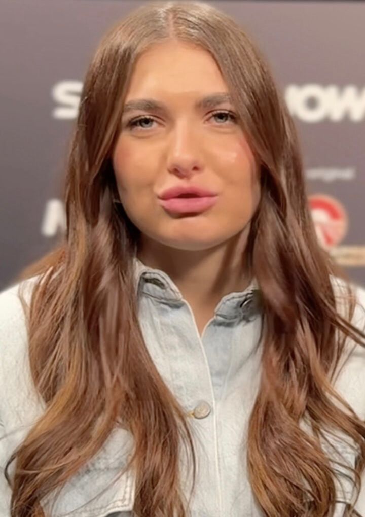 chanel totti prima e dopo